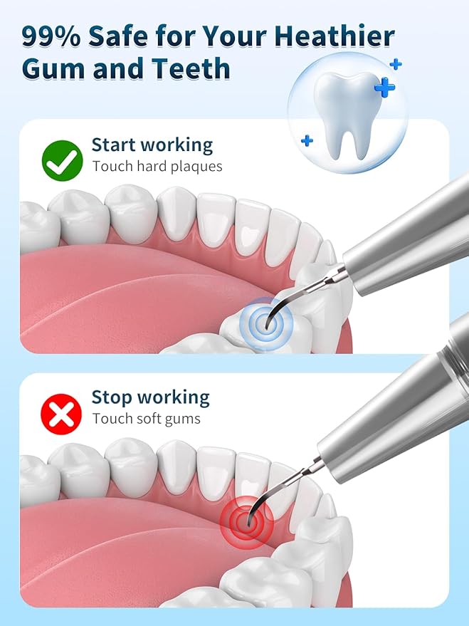 Plaque Remover for Teeth - Teeth Cleaning Kit Tartar Remover for Teeth with LED Light & 5 Adjustable Modes, USB C Rechargeable, 4 Replaceable Heads&6 Dental Tools, IPX7 Waterproof for Home Use