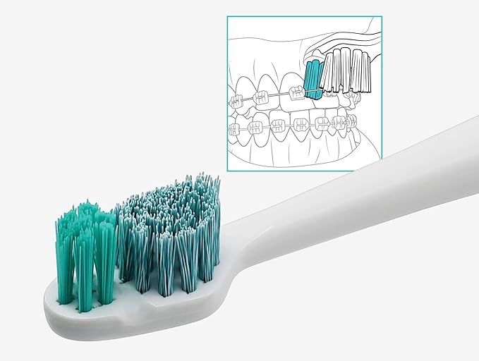 TAO Clean Sonic Electric Toothbrush Replacement Heads (2-Pack) – Orthodontic Head – Replacement Heads for the TAO Clean Electric Toothbrush and Docking Station