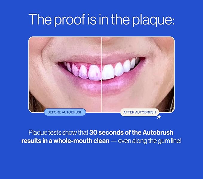 Autobrush Sonic Pro Electric Toothbrush – Only ADA Accepted U-Shaped Brush, Clinically Proven Up to 5.1X Better Cleaning, 30-Second Full Mouth 360 Clean, Rechargeable, Waterproof, White, Women's Small