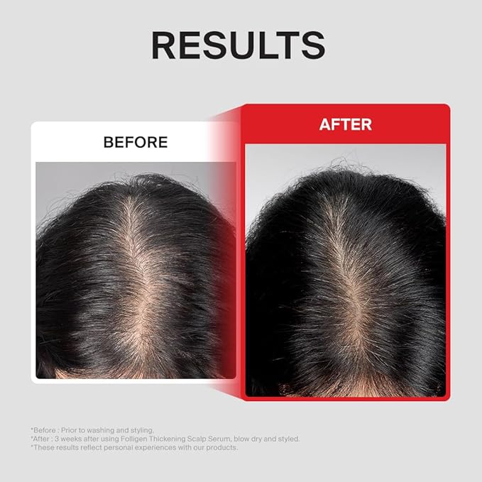 Dr.FORHAIR Folligen Thickening Scalp Serum 1.7 oz | Biotin Density Serum for Thicker, Fuller-Looking Hair | Peptide Scalp Treatment | Korean Haircare