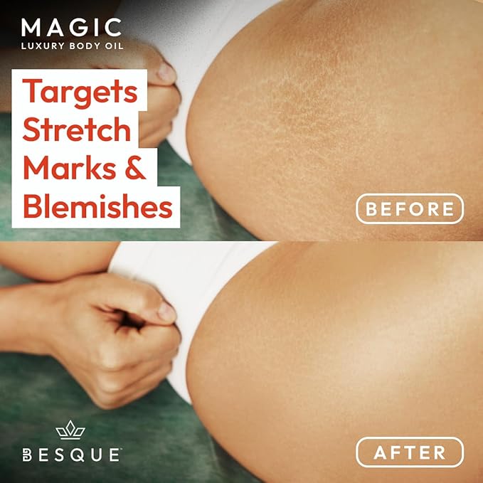 Besque Original Magic Body Oil, 3.4 FL OZ, After Shower Body Oil For Women, Hydrating Skin Care For Full Body That Plumps, Tightens, & Firms Skin With Natural Ingredients, Made In UK - Pack of 1