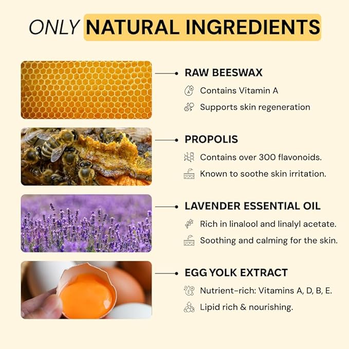 MyMagicHealer Universal Flare Care – Solution for Everyday Skin Flare-Ups | Drawing Salve for Boils & Cysts, Hidradenitis Suppurativa, Folliculitis | Irritated Skin and Chafing Relief 1 oz