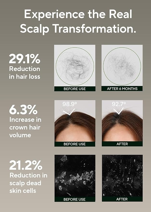AROMATICA Rosemary Salt Scrub Shampoo - Hair Loss Korean Scalp Detox Shampoo with Rosemary Scalp Oil | Scalp Exfoliator with Salt Scrub for Oily Scalp | Sulfate Free, Silicone Free (10.5 oz / 300g)
