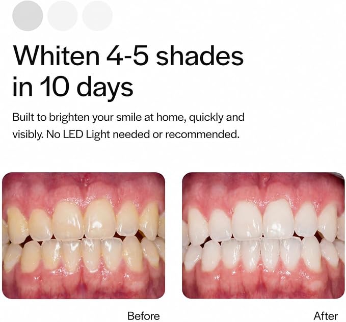 Opalescence Go 15 - Prefilled Teeth Whitening Trays Bundle 6238-1TS | Hydrogen Peroxide 15% - Includes Original Whitening Toothpaste Travel Size 1 Oz & Tongue Scraper (7 Treatments) Mint Flavor