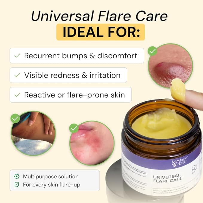 MyMagicHealer Universal Flare Care – Solution for Everyday Skin Flare-Ups | Drawing Salve for Boils & Cysts, Hidradenitis Suppurativa, Folliculitis | Irritated Skin and Chafing Relief 4 oz