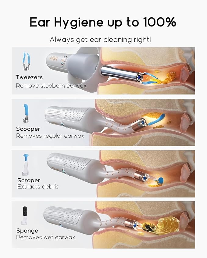 Bebird Earsight Plus R37R Ear Wax Removal Tool Camera, FSA HSA Eligible Items, Smart Ear Cleaner with Painless Visual Tweezers, Flexible Ear Camera Otoscope, Home ENT Cleaning Kit for Family,White