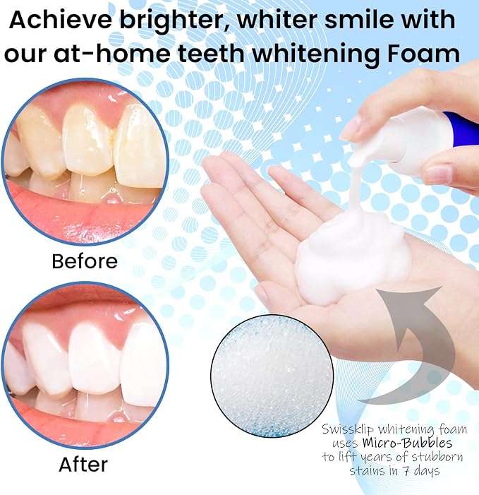 Swissker by Swissklip ShineFoam Teeth Whitening Foam – Stain Remover | Whitening Gel Kit, Teeth Whitener, Hydrogen Peroxide Formula, Mint Flavor, Coffee & Wine Stain Removal, For Braces & Aligners