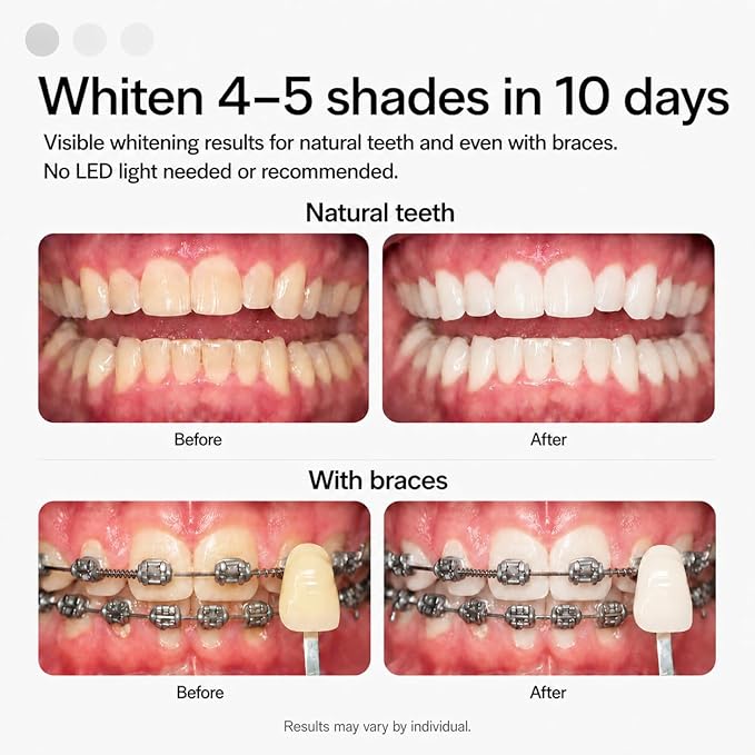 Opalescence Go Teeth Whitening Kit 15% Hydrogen Peroxide 7 Treatments with Original Toothpaste 4.7 oz and 1 oz Travel Size Plus Alcohol Free Mouthwash and Toothbrush 5166-5447-6238T