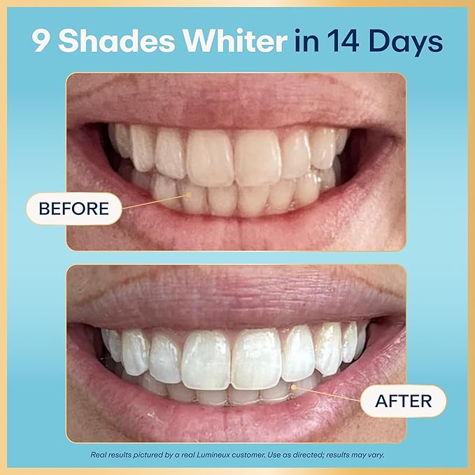 Lumineux Teeth Whitening Strips, Peroxide Free, 21 Treatments (3 Months) | Peroxide free, enamel safe, dentist formulated, clinically tested & proven, free from harsh ingredients, no sensitivity