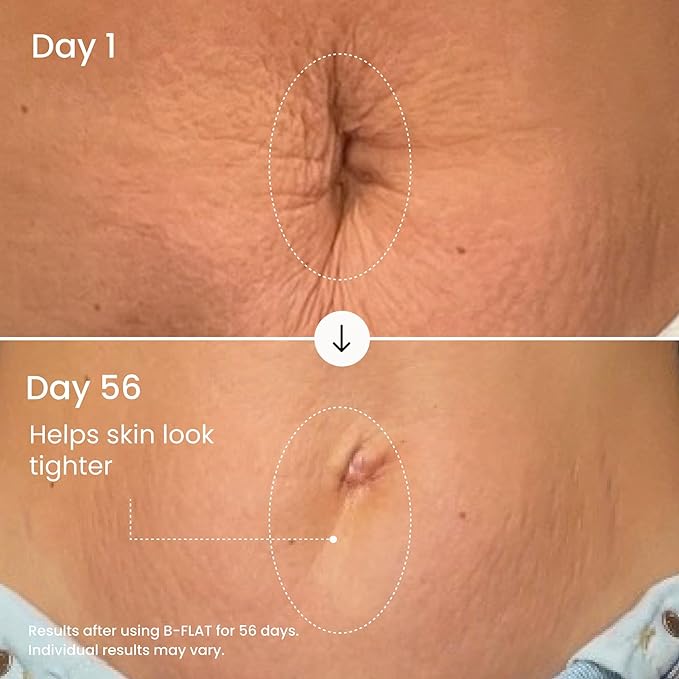 MAËLYS B-FLAT Belly Firming Cream for Women - Skin Tightening & Moisturizing Treatment with Shea Butter & Bentonite Clay - Smooths Look of Stretch Marks - Postpartum Body Care (3 Pack)