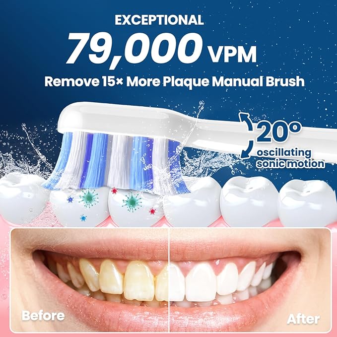 Electric Toothbrush, Sonic Toothbrush for Adults Teens with Pressure Sensor, AI Zone Cleaning Tracking, 5 Modes & 3 Intensities, 180 Days Battery Life, 4 Brush Heads with Travel Case, White