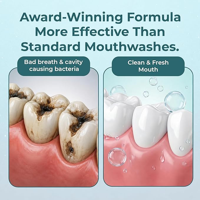 ioRinse AC Anticavity Fluoride Mouthwash - Alcohol-Free Molecular Iodine Mouth Wash Fights Tooth Decay & Protects Enamel - Safe Mint Rinse for Sensitive Mouths - Potent Bad Breath Protection - 33.8 oz