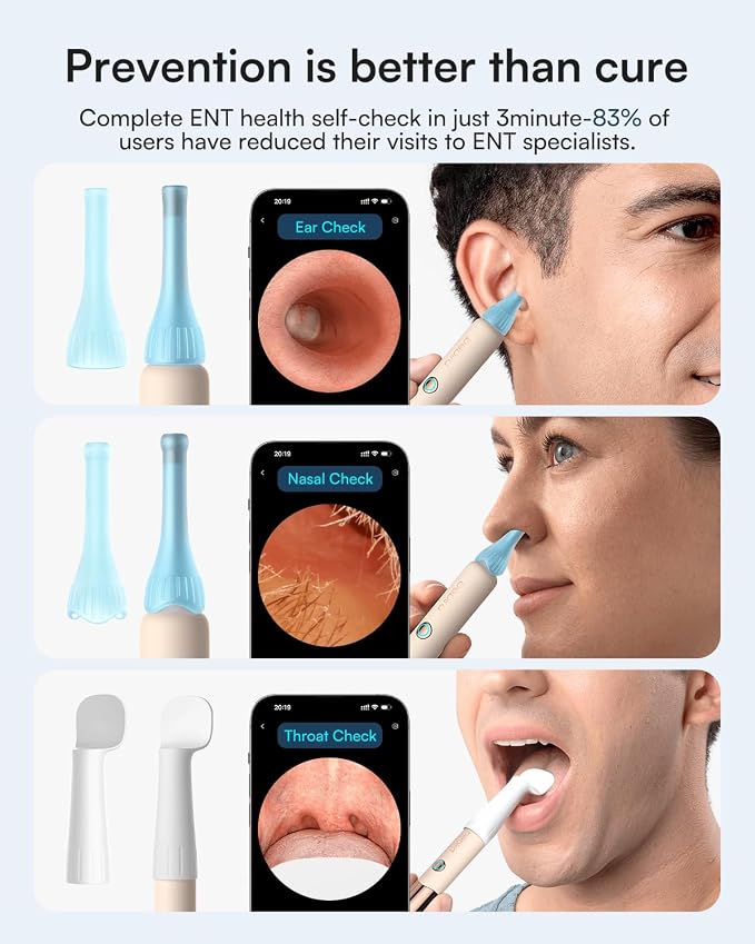 Bebird Earsight Ultra 2K Ear Wax Removal Tool Camera,Pain-Free Ear Cleaner with HD Otoscope,Visual Ear Pick Tweezers, Safe Silicone Tips,Ear Cleaning Kit for Family, FSA HSA Eligible (Champagne Gold)
