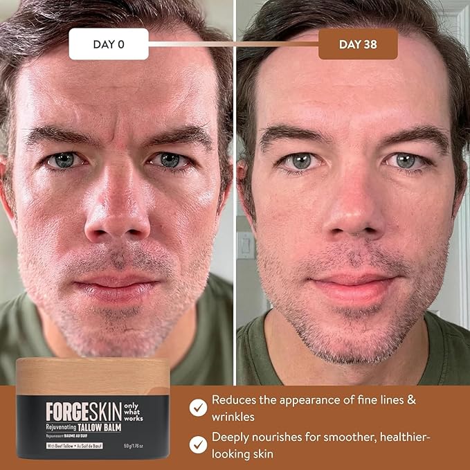 Forge Skin Beef Tallow Balm Moisturizer for Men Skin Care - Face + Body Anti Aging Wrinkle Defense, Hydration Cream - Natural Ancestral Skincare Lotion (1.7 OZ) 6pk