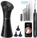 Ear Wax Removal Kit with Camera – Ear Cleaner Tool for Safe & Effective Ear Care – Includes Ear Camera for Visual Inspection & Gentle Ear Irrigation System – Complete Ear Cleaning Solution | Complete Ear Cleaning Kit, Visual, Waste Collection Tank, Ove...