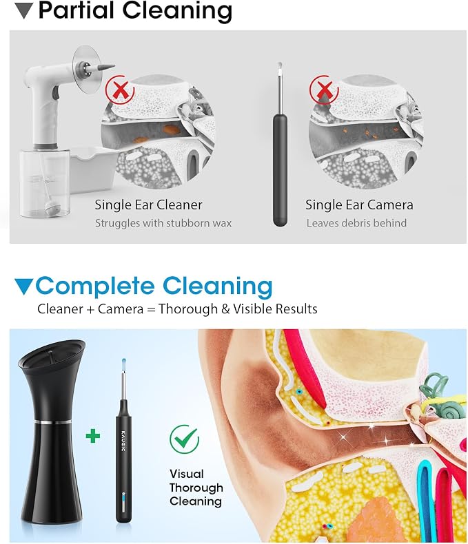 Ear Wax Removal Kit with Camera – Ear Cleaner Tool for Safe & Effective Ear Care – Includes Ear Camera for Visual Inspection & Gentle Ear Irrigation System – Complete Ear Cleaning Solution | Complete Ear Cleaning Kit, Visual, Waste Collection Tank, Ove...