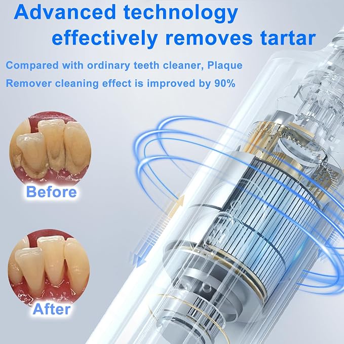 Plaque Remover for Teeth - SIQUER Teeth Cleaning Kit Dental Tools | LED Light 5 Speed Modes 4 Replaceable Heads USB Rechargeable for Home Travel Use, Black