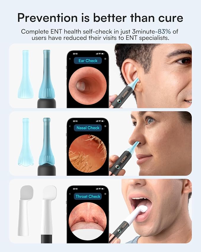 Bebird Earsight Ultra 2K Ear Wax Removal Tool Camera,Pain-Free Ear Cleaner with HD Otoscope,Visual Ear Pick Tweezers, Safe Silicone Tips,Ear Cleaning Kit for Family, FSA HSA Eligible (Starlight Black)