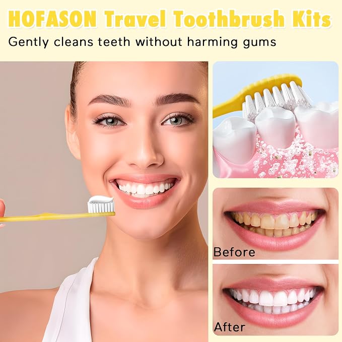 HOFASON Disposable Toothbrushes with Toothpaste Pack of 30, Yellow Hollow Travel Toothbrush Set with 5g Bulk Toothpaste Individually Wrapped for Homeless, Nursing Home, Shelter, Hotel