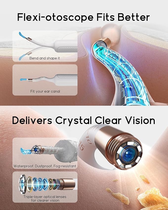 Bebird Earsight Plus R37R Ear Wax Removal Tool Camera, FSA HSA Eligible Items, Smart Ear Cleaner with Painless Visual Tweezers, Flexible Ear Camera Otoscope, Home ENT Cleaning Kit for Family,White