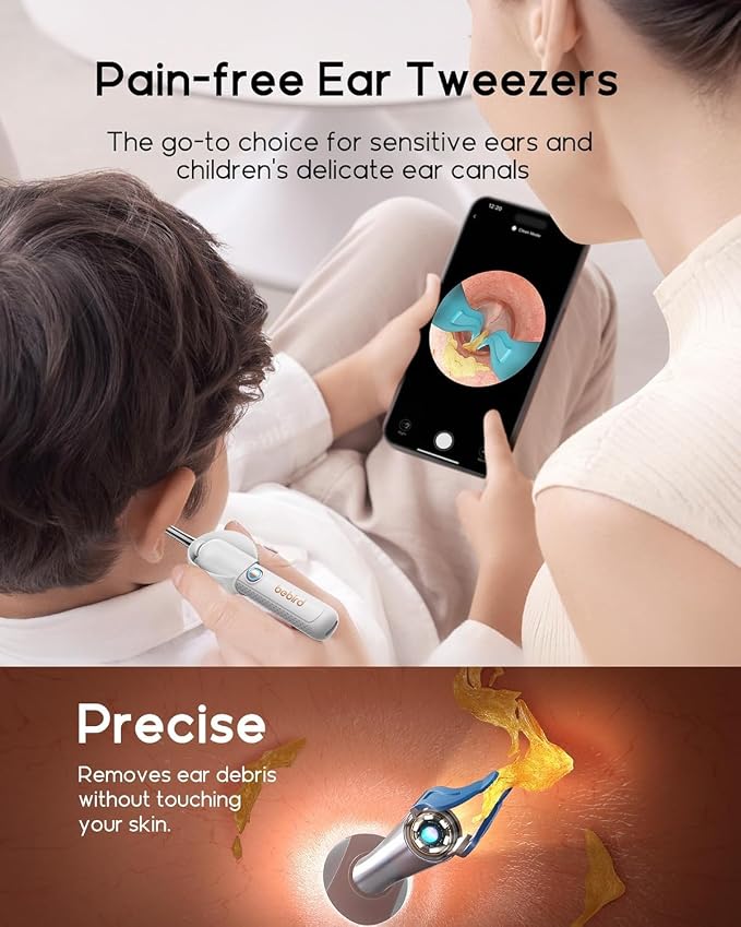 Bebird Earsight Plus R37R Ear Wax Removal Tool Camera, FSA HSA Eligible Items, Smart Ear Cleaner with Painless Visual Tweezers, Flexible Ear Camera Otoscope, Home ENT Cleaning Kit for Family,White