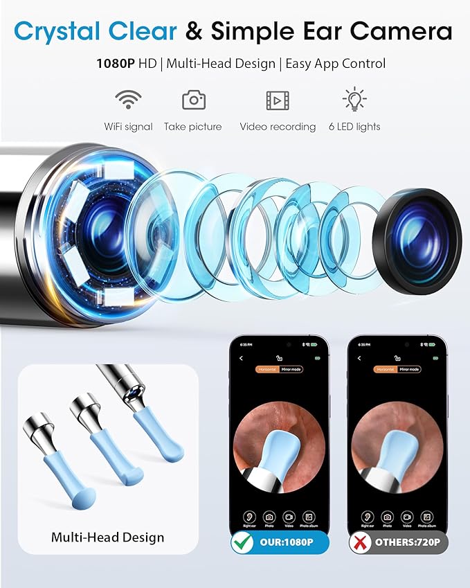 Ear Wax Removal Kit with Camera – Ear Cleaner Tool for Safe & Effective Ear Care – Includes Ear Camera for Visual Inspection & Gentle Ear Irrigation System – Complete Ear Cleaning Solution | Complete Ear Cleaning Kit, Visual, Waste Collection Tank, Ove...