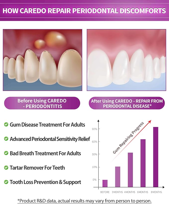 CAREDO Gum Toothpaste for Periodontitis, Gum Repair for Receding Gums, Gum Disease & Gingivitis Treatment, Periodontal Disease Treatment for Gum Health, Gum Disease Repair Bad Breath Toothpaste 3.52OZ