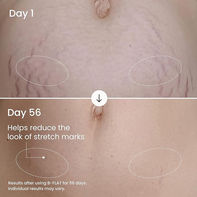 MAËLYS B-FLAT Belly Firming Cream for Women - Skin Tightening & Moisturizing Treatment with Shea Butter & Bentonite Clay - Smooths Look of Stretch Marks - Postpartum Body Care (2 Pack)