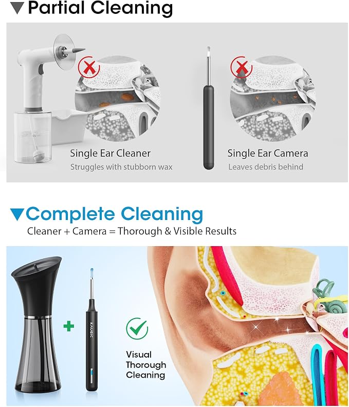 KAUGIC Ear Wax Removal Kit with Camera – Ear Cleaner Tool for Safe & Effective Ear Care – Includes Ear Camera for Visual Inspection & Gentle Ear Irrigation System – Complete Ear Cleaning Solution | Complete Ear Cleaning Kit, Visual, Waste Collection Ta...