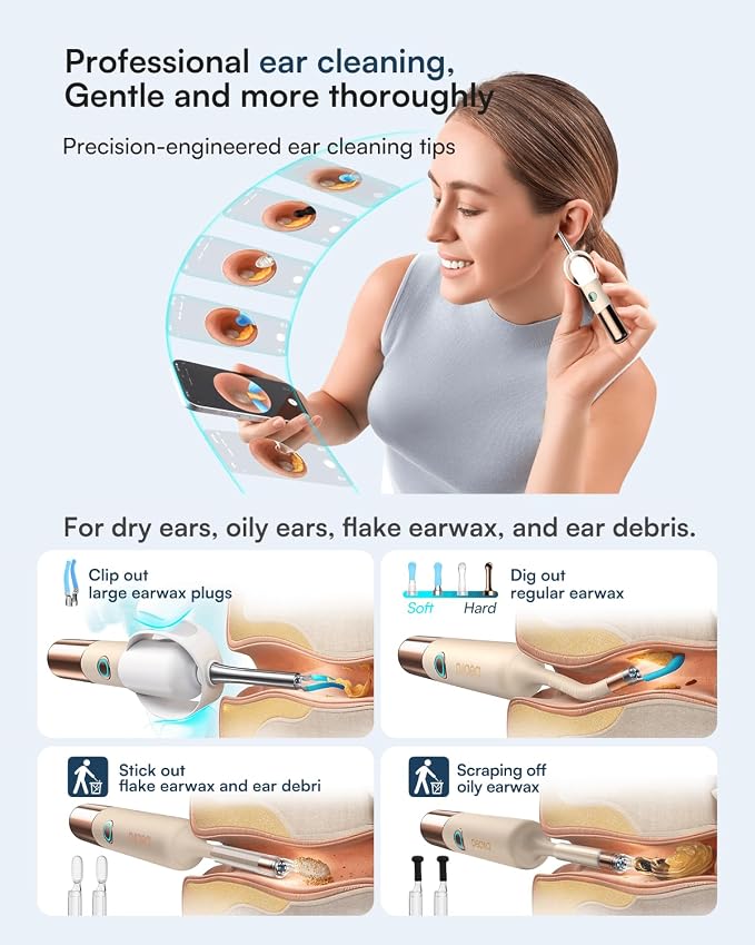 Bebird Earsight Ultra 2K Ear Wax Removal Tool Camera,Pain-Free Ear Cleaner with HD Otoscope,Visual Ear Pick Tweezers, Safe Silicone Tips,Ear Cleaning Kit for Family, FSA HSA Eligible (Champagne Gold)