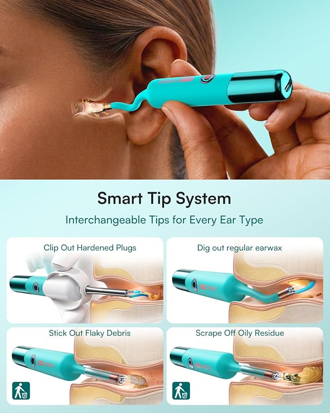Bebird EarSight Ultra X 4K HD Ear Wax Removal Tool Camera with Luxury Gift Box, FSA HSA Eligible, Premium Smart Ear Cleaner Otoscope, Perfect Birthday Mothers Fathers Day Gift for Family, Aurora Blue