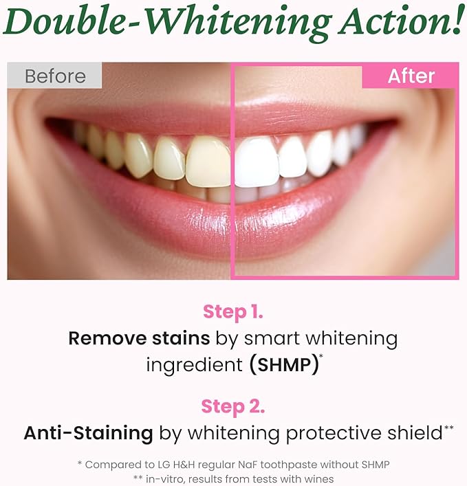 EUTHYMOL Whitening Toothpaste, Stain Removal in 2weeks | 3.7 floz*2 (2Pack) | Whitening Toothpaste for sensitive Gum & Teeth, Stain Removal in 2 Weeks, Bad Breath, Cavity Prevention, Aluminum Tube