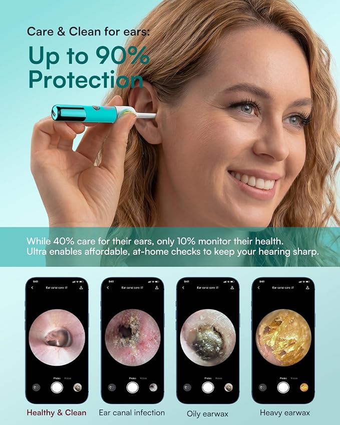 Bebird EarSight Ultra X 4K HD Ear Wax Removal Tool Camera with Luxury Gift Box, FSA HSA Eligible, Premium Smart Ear Cleaner Otoscope, Perfect Birthday Mothers Fathers Day Gift for Family, Aurora Blue