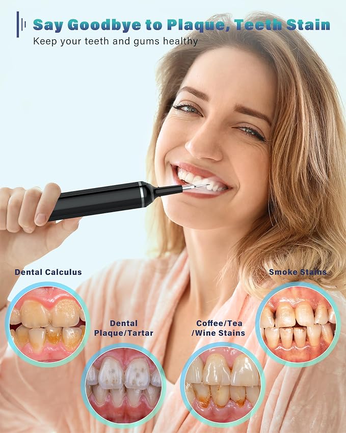 Plaque Remover for Teeth, Dental Cleaning Kit Tartar Remover for Teeth with LED Light & 5 Modes, Rechargeable Dental Cleaner, 4 Replaceable Heads