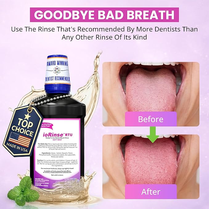ioRinse RTU Halitosis Mouthwash for Fresh Breath, Dentists' Top Choice, Alcohol Free & Fluoride Free Molecular Iodine Oral Rinse, Soft Mint, Professional Clean Mouth Wash, RTU Mouthwash 33.8 oz