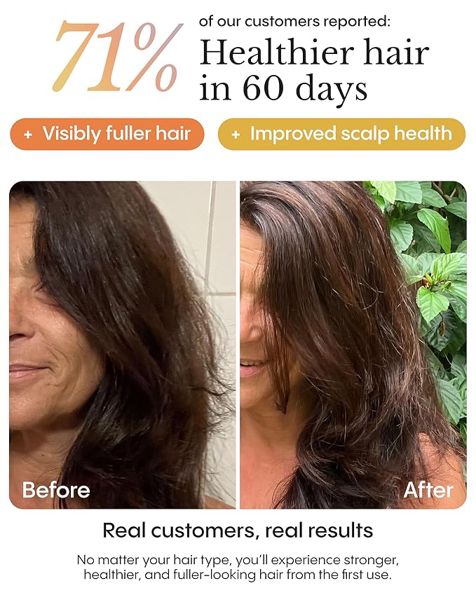 Frøya Organics The Complete System For Mature Hair & Scalp | Scalp Balance and Fuller Looking Hair | Rosemary Pumpkin Seed Turmeric Calendula | Botanical Formula | 60 Day Supply