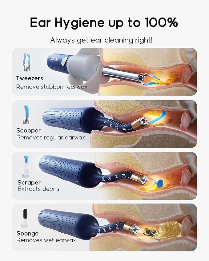 Bebird Earsight Plus R37R Ear Wax Removal Tool Camera, FSA HSA Eligible Items, Smart Ear Cleaner with Painless Visual Tweezers, Flexible Ear Camera Otoscope, Home ENT Cleaning Kit for Family,Blue