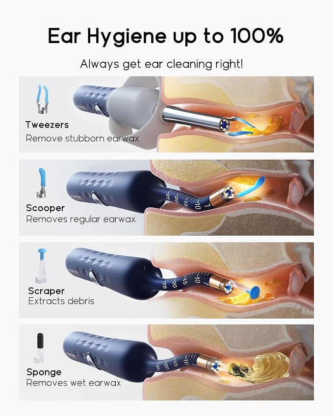 Bebird Earsight Plus D39R Ear Wax Removal Tool Camera, FSA HSA Eligible Items, Ear Cleaner with Flexible Ear Camera Otoscope, Visual Ear Pick Tweezers Wax Remover, Ear Cleaning Kit for Family