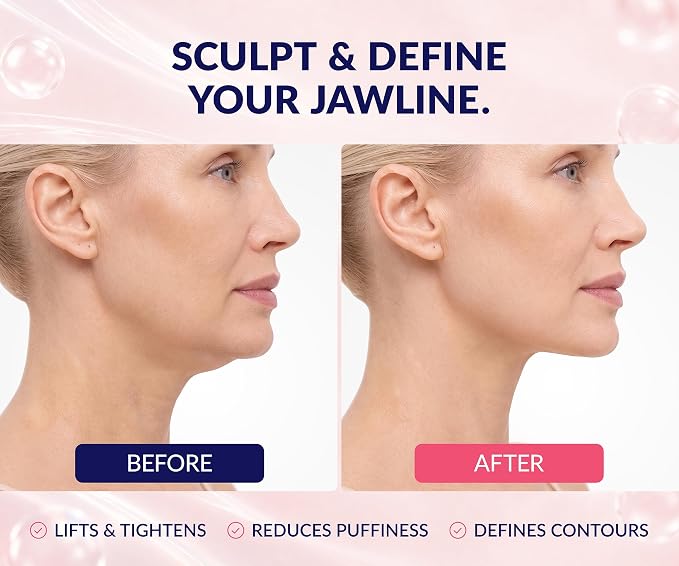 STYLIA V Line Lifting Collagen Face Mask - Lift, Firm & Contour Jawline - Double Chin Strap with Hyaluronic Acid & Aloe Vera - Hydrating Neck & Face Tightening Mask - Chin Strap for Sleeping - 20PC