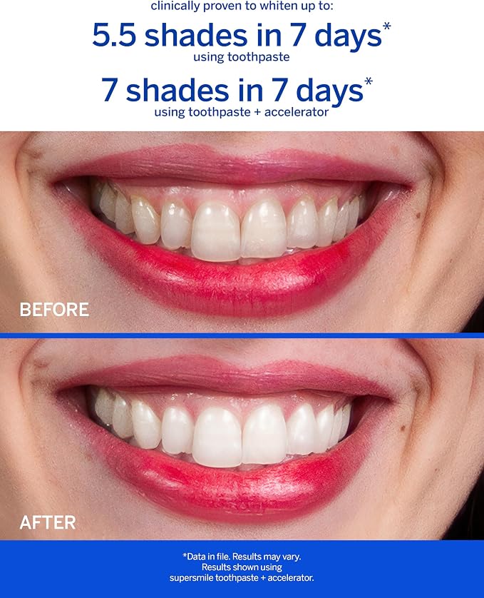 Supersmile ICY Mint Whitening Toothpaste, Fluoride-Free, 8 Oz | Calprox® Powered, Whitens 5.5 Shades in 7 Days, Frosty Peppermint Menthol Crystals, Veneer Safe, Sensitivity-Free