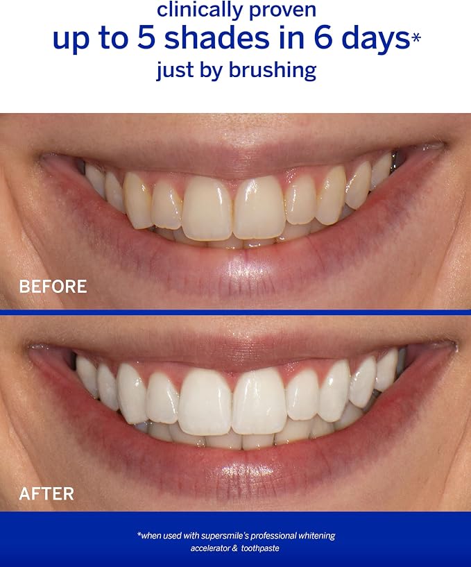 Supersmile Rosewater Mint Whitening Toothpaste, Fluoride-Free, 4.2 Oz | Calprox® Powered, Whitens 5.5 Shades in 7 Days, Moroccan Rosewater + Spearmint Blend, Veneer Safe, Sensitivity-Free