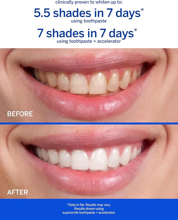 Supersmile Rosewater Mint Whitening Toothpaste, with Fluoride, 8 Oz | Whitens 3 Shades After 1 Day, Moroccan Rosewater + Spearmint Flavor, Veneer Safe, RDA 65, Cavity Protection
