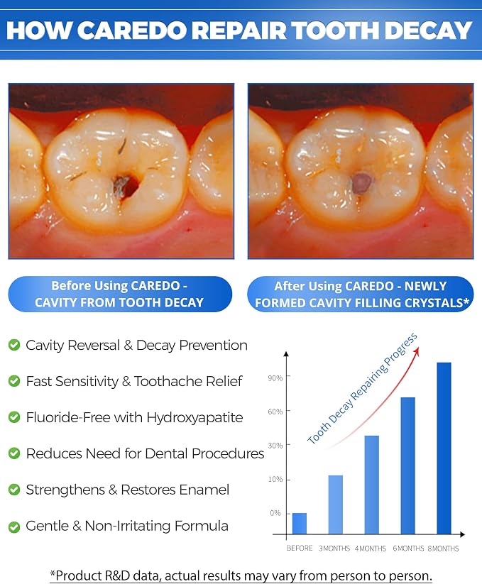 CAREDO Cavity Reversal Hydroxyapatite Toothpaste for Adults, Cavity Tooth Filler as Home Cavity Repair, Fluoride Free Reverse Cavities Treatment for Tooth Decay Repair, Remineralizing Repair 3.52OZ