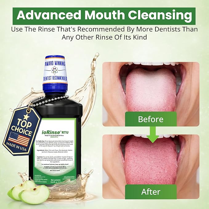 ioRinse Ready-to-Use (RTU) Mouthwash for Fresher Breath, Halitosis Relief, Alcohol-Free, Fluoride-Free and a Professional Clean, Original ioRinse RTU Mouth Wash, Zero Alcohol - Green Apple Flavor, 1L