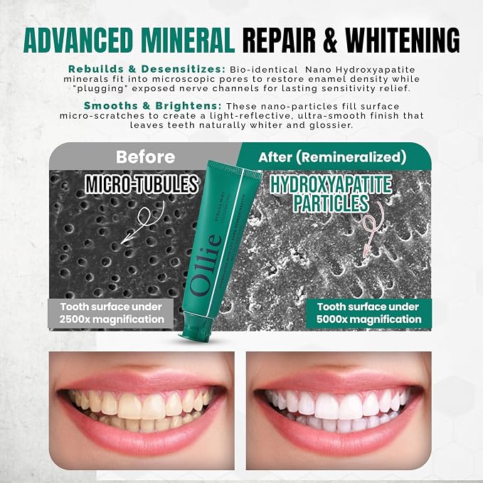 Ollie Fluoride Free 10% Nano Hydroxyapatite Toothpaste, Strong Mint, 4oz | Rod-Shaped Nano HAP, Remineralizes Enamel, Reduces Sensitivity, Reverses Small Cavities, Naturally Whitens Teeth, (Pack of 1)