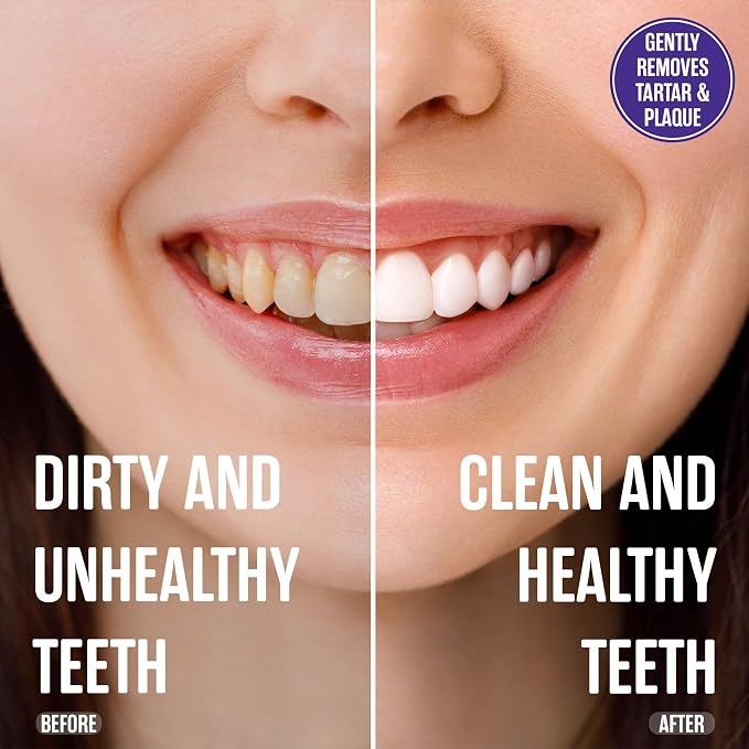 SprinJene Sensitive Relief Fluoride Free Toothpaste - Patented Natural Toothpaste with Black Seed Oil & Zinc - Made in The USA - Vegan Non Fluoride for Fresh Breath Preservative Free (2 Pack)