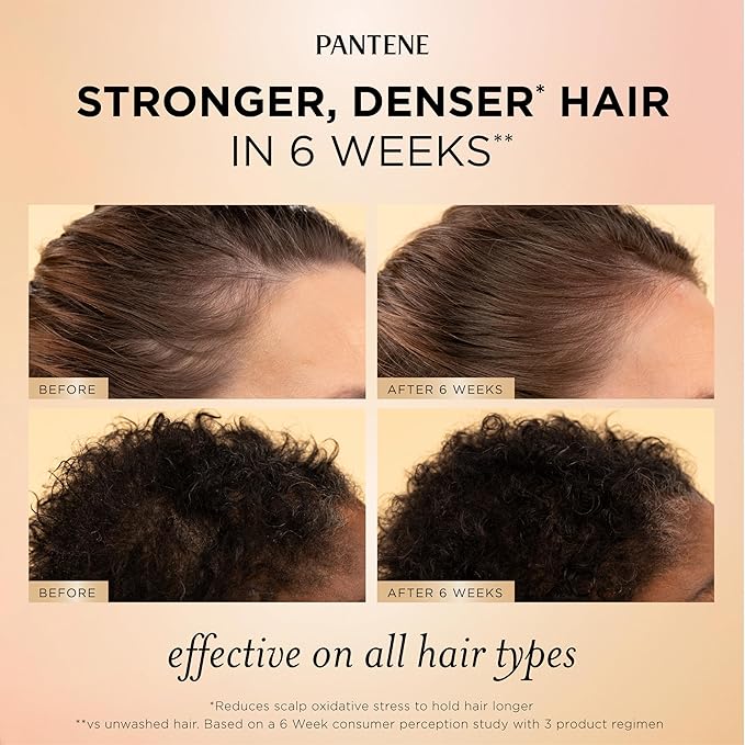 Pantene Abundant & Strong 3-Piece Regimen with B5 Complex + Niacinamide, Shampoo (13.5 oz), Conditioner (8 oz), Serum (2 oz) for Hair Loss, Thinning, Anti-Breakage, Volume - Grows Healthier