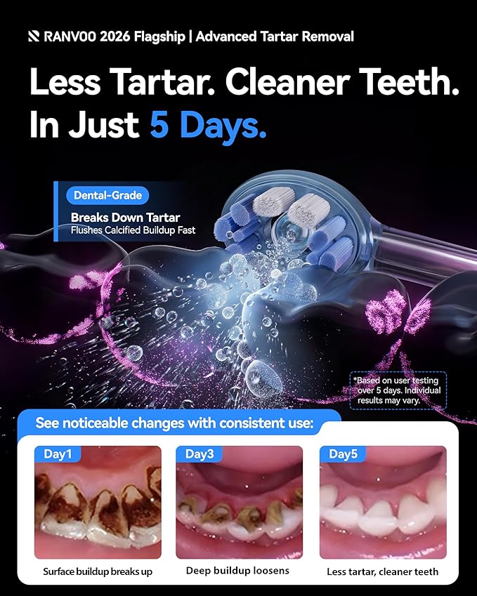 RANVOO AirJet X5 [New-Gen Jet Clean | Max Tartar Removal] Electric Toothbrush, 100% Plaque Removal, Whitening & Gum Care, 60-Day Battery Life, Rechargeable with 3 Pro Brush Heads, Light Blue