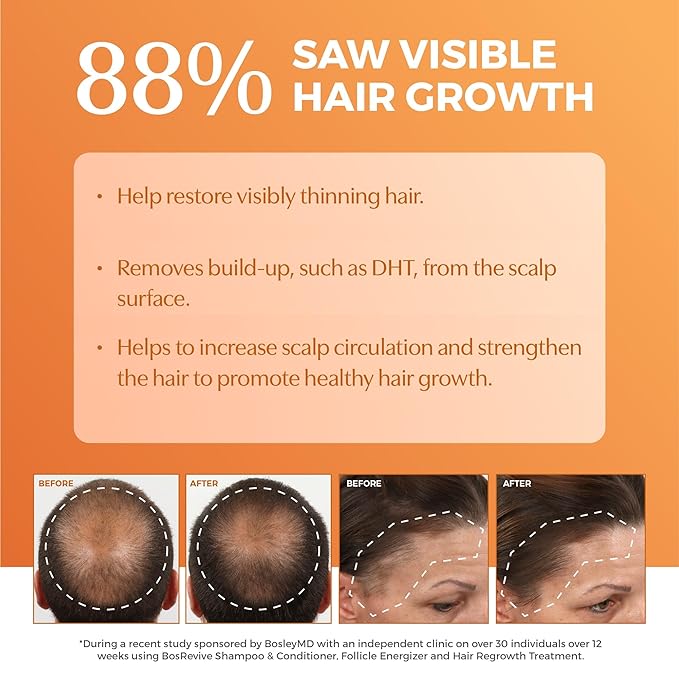 BosRevive Volumizing Conditioner for Thinning, Color/Chemically-Treated Hair – DHT Blocker, Sulfate-Free, Vegan, Biotin, Saw Palmetto & Rosemary – Thicker, Fuller Hair – 33.8 Fl Oz.