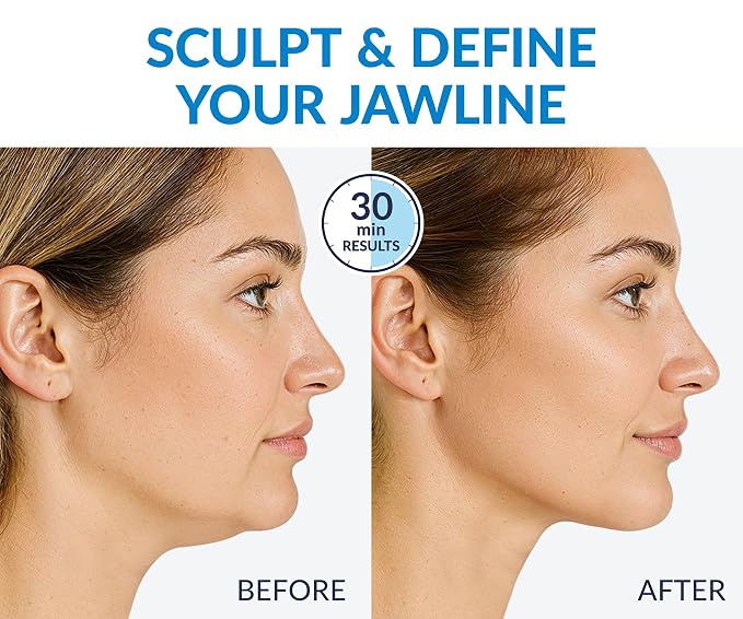 Stylia MaxiLift V-Line Lifting Collagen Face Mask - Double Chin Strap - Jawline Shaper - Neck Firming and Tightening Mask with Hyaluronic Acid & Aloe Vera - Chin Strap for Sleeping (5PC)